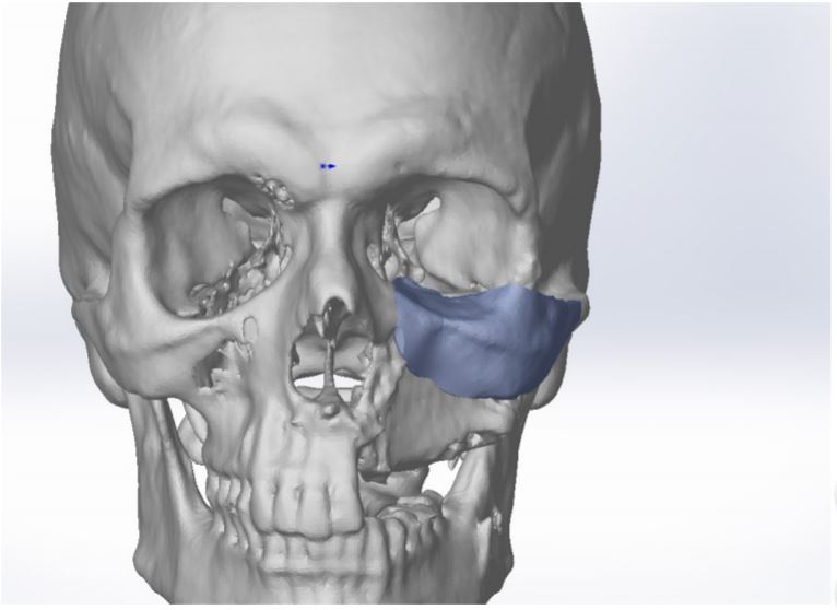 Figure 10.JPG